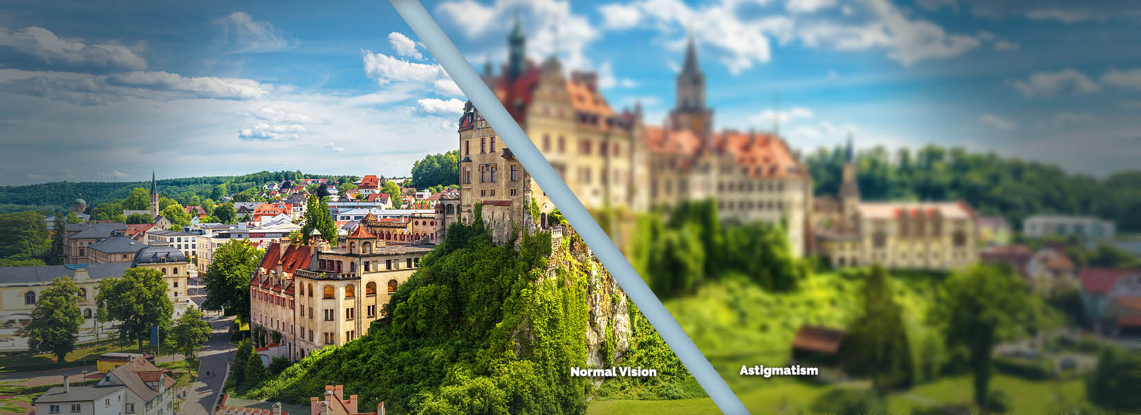Astigmatism Treatment in Stone Oak