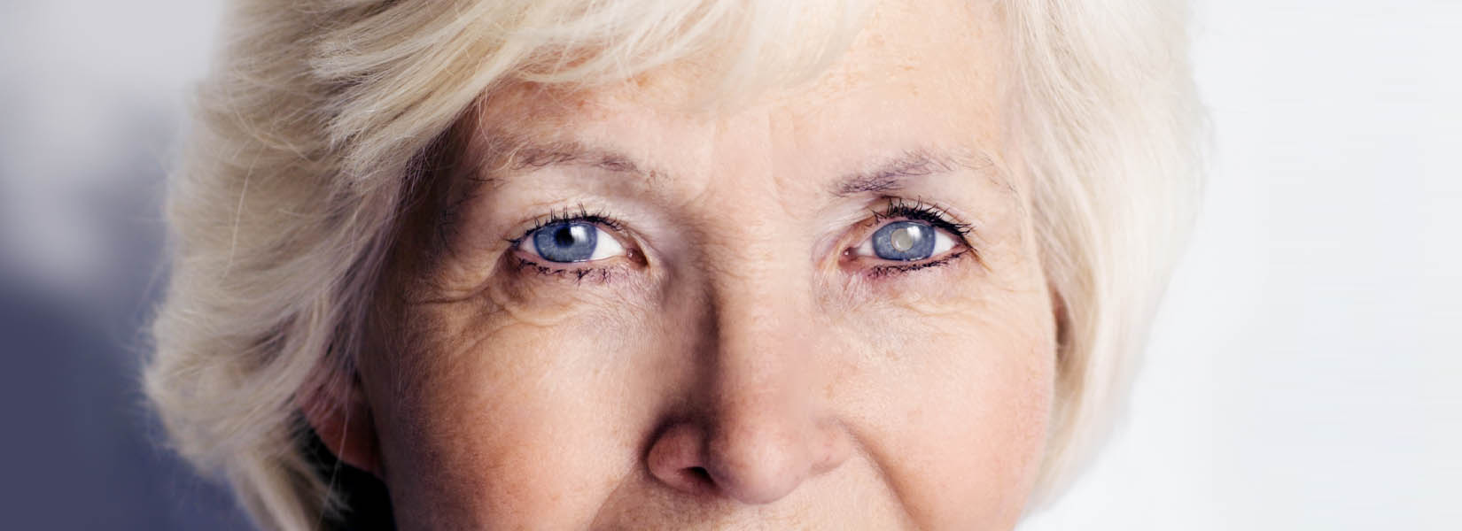 Cataract Surgery in Stone Oak